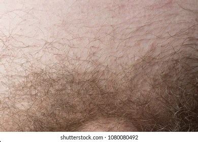 men with bushy pubes|7 Factors Influencing Male Pubic Hair Patterns .